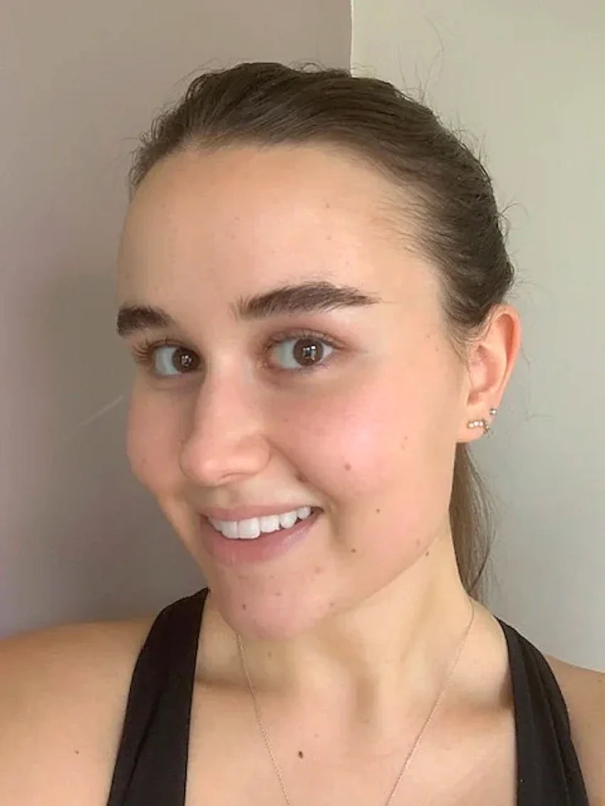 Dry, uneven skin