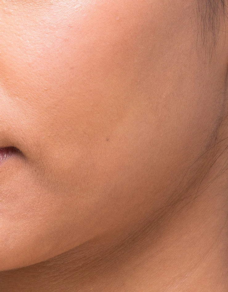 Dullness & fine lines